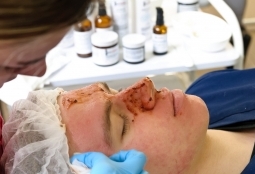 Galeria | WUMed | Zaawansowane techniki peeling'u - warsztaty dla studentów kosmetologii | Zdjęcie: 36